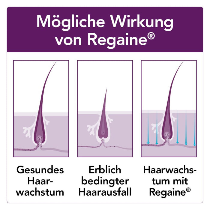 Regaine Frauen Lösung, 60 ml Solution