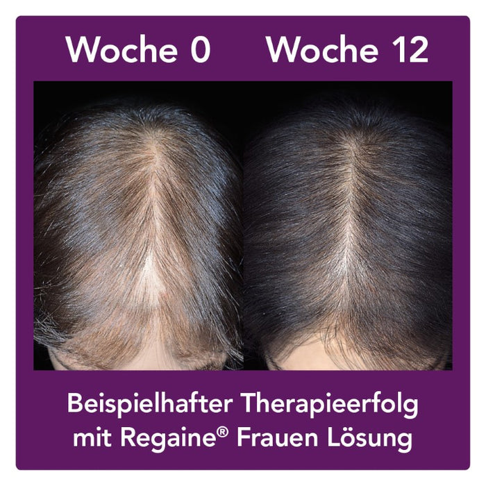 Regaine Frauen Lösung, 180 ml Solution